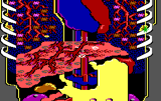 Gameplay of Microsurgeon