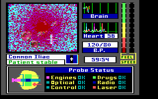 Gameplay of Laser Surgeon: The Microscopic Mission