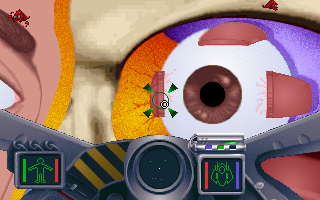 Gameplay of Bodyworks Voyager: Missions in Anatomy